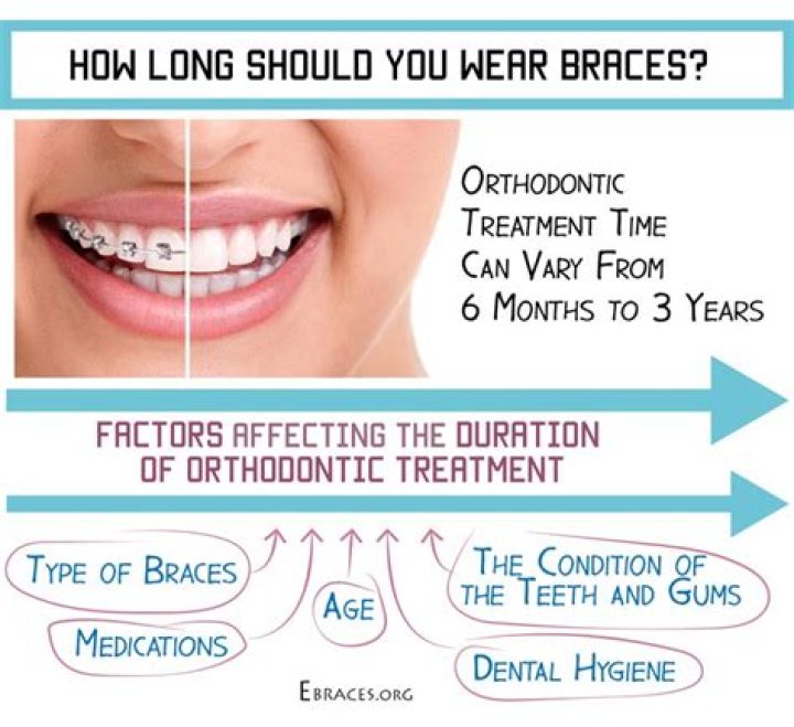 How long do braces last?