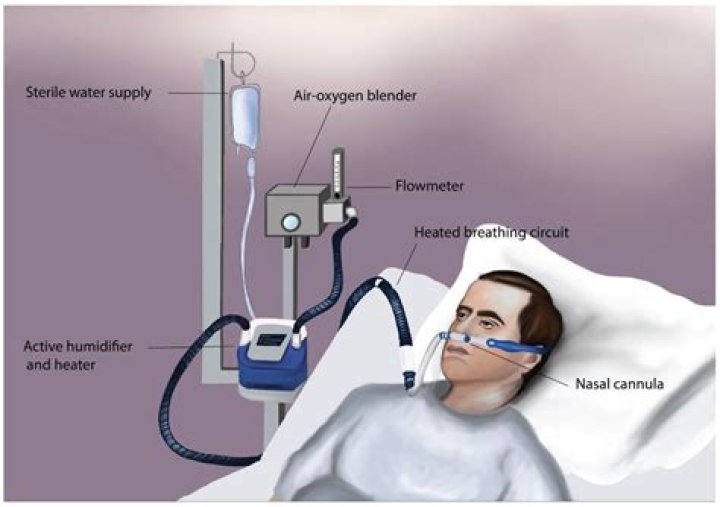 How long do patients stay on ventilators?