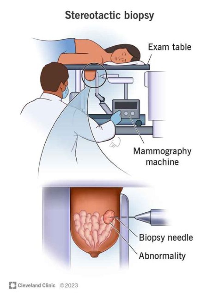 How long does a throat biopsy take?