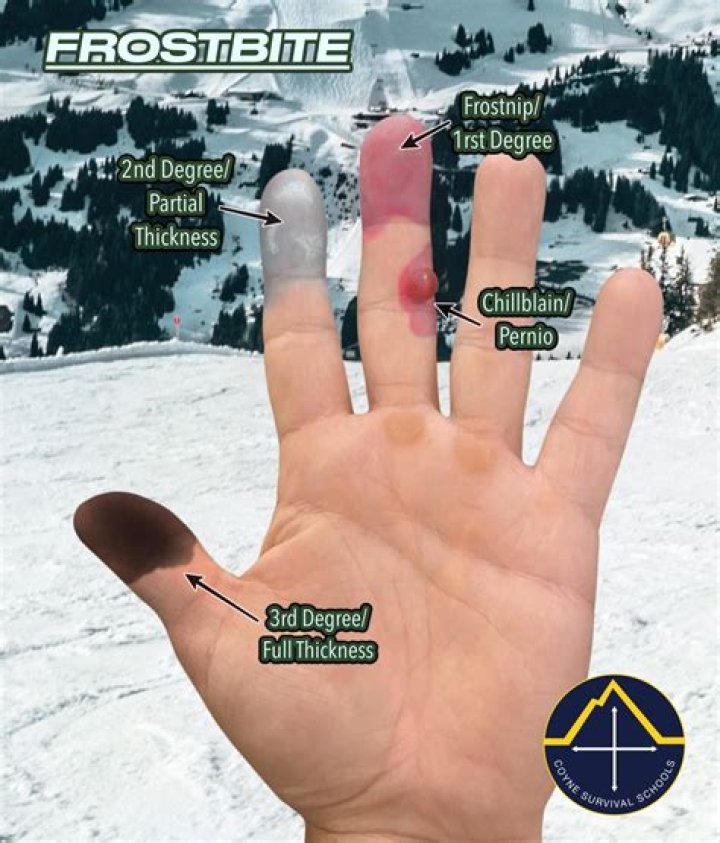 How long does it take to get rid of ant infestation?