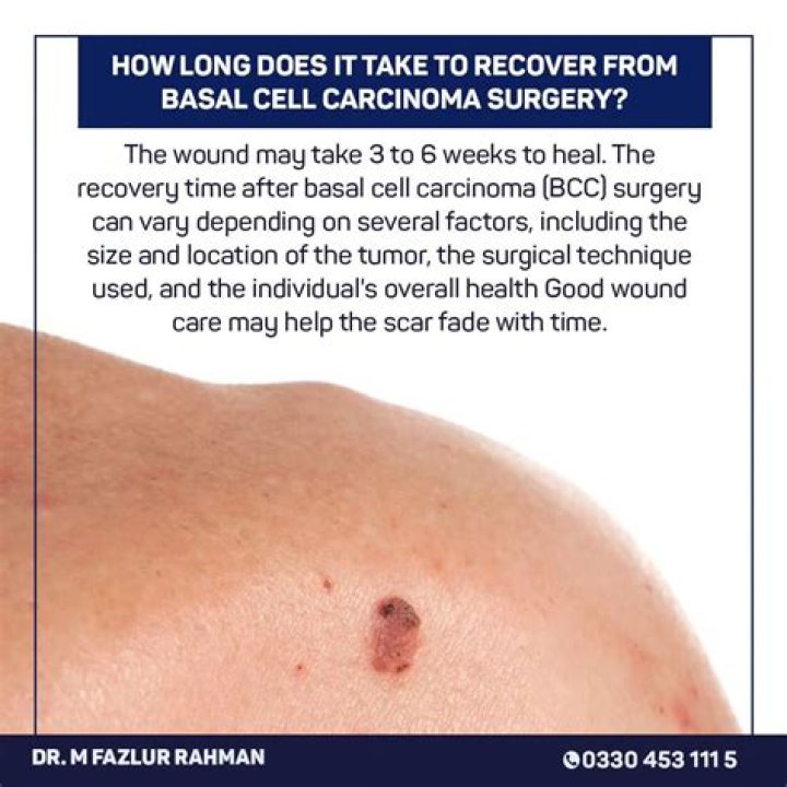 How long does it take to recover from basal cell carcinoma surgery?