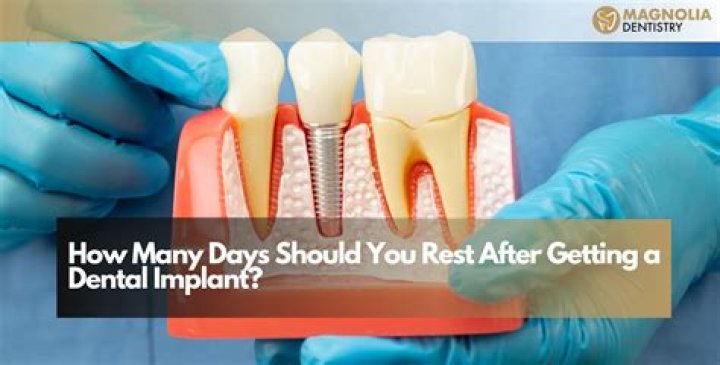 How many days rest after dental implant?