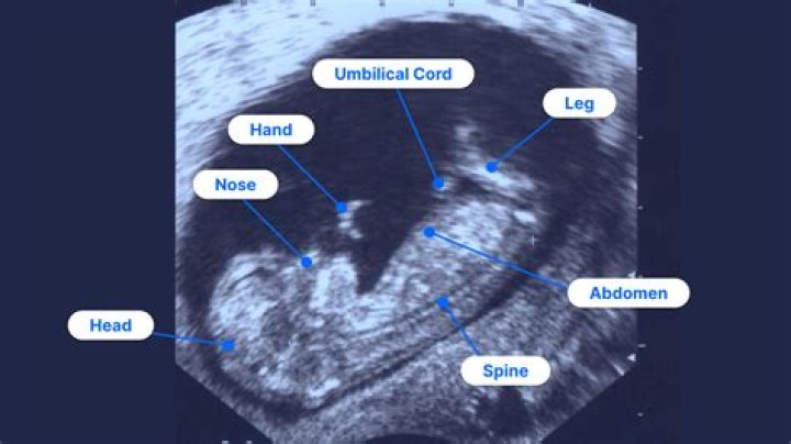 How many ultrasounds are too many during pregnancy?