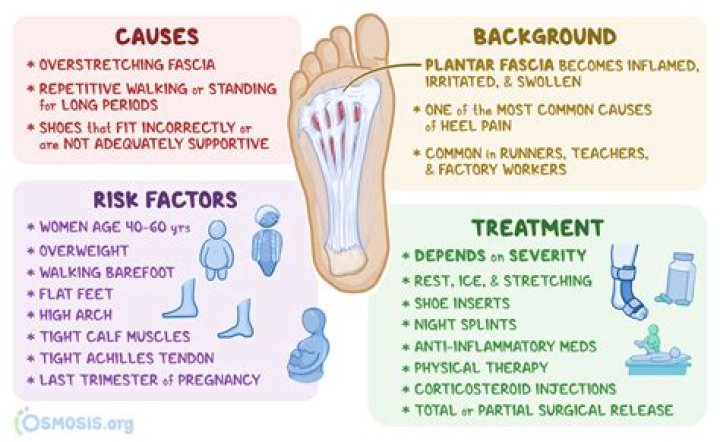 How much disability is plantar fasciitis?