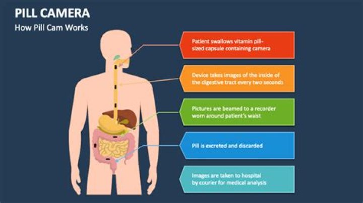 How much does a pill camera cost?