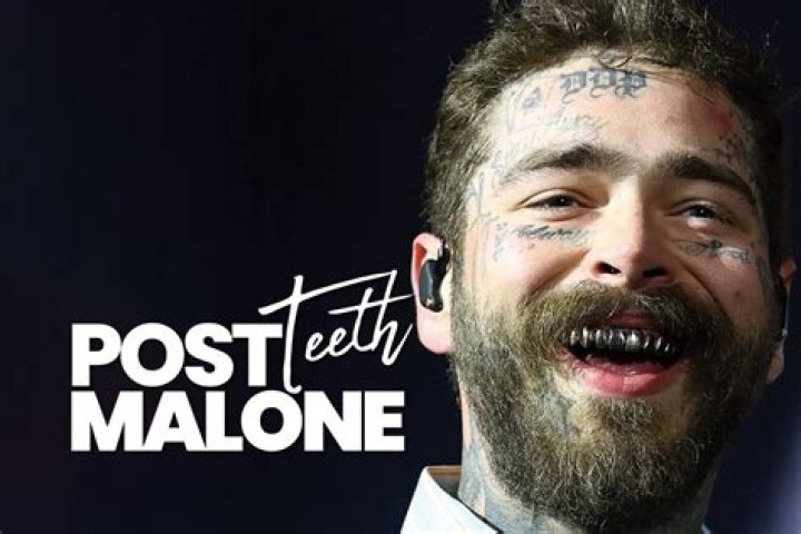 How much is Post Malone's teeth worth?