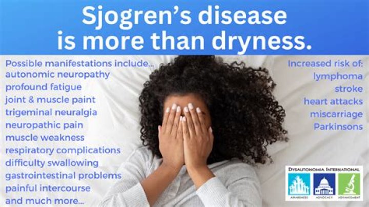 How often do people with Sjogren's get lymphoma?
