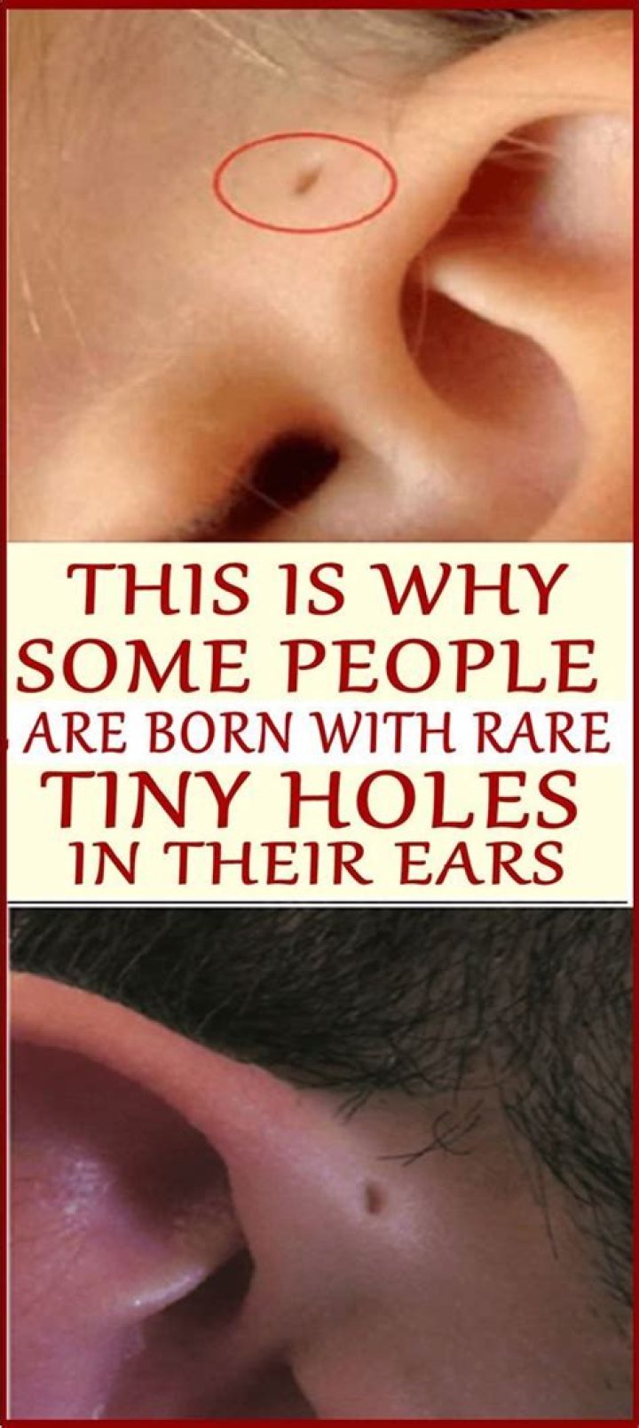 How rare is it to have a hole in your ear?