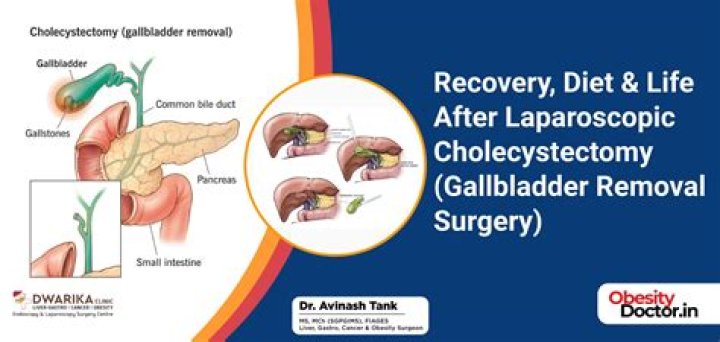 How will my life change after gallbladder removal?