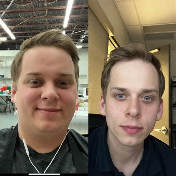How your face changes when you lose weight?
