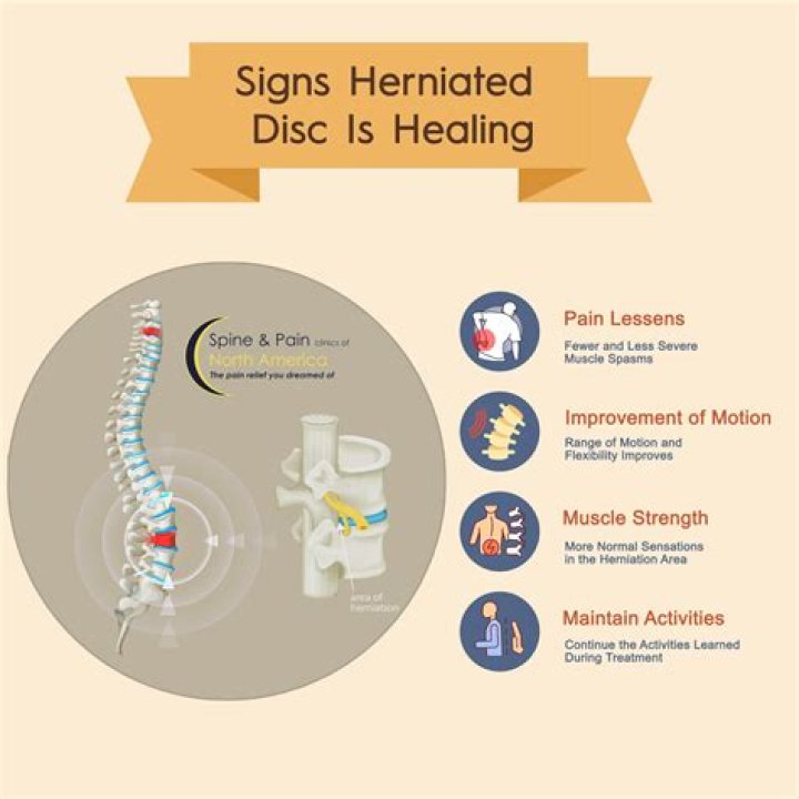 Is a back brace good for a herniated disc?
