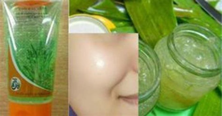 Is Aloe Vera good for pimples?