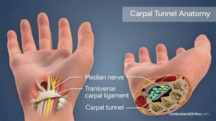 Is CBD oil good for carpal tunnel?