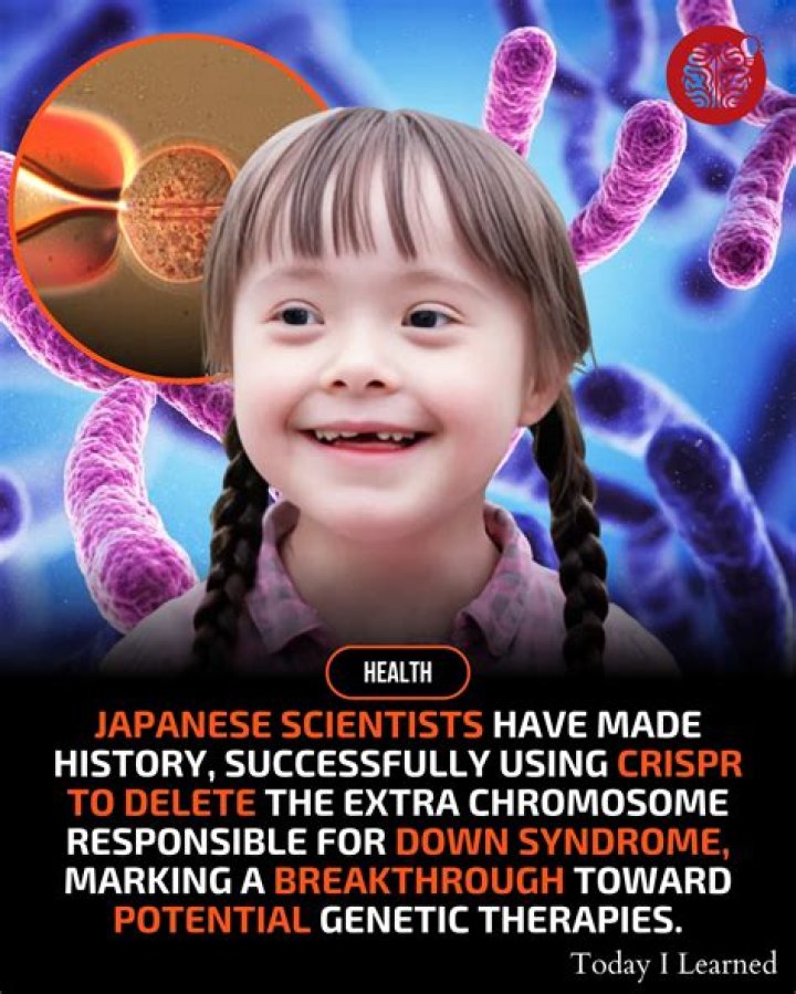 Is Down syndrome genetic?