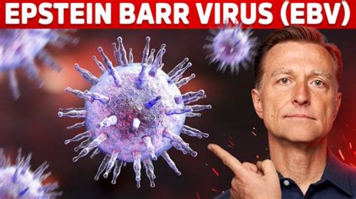 Is Epstein Barr an STD?