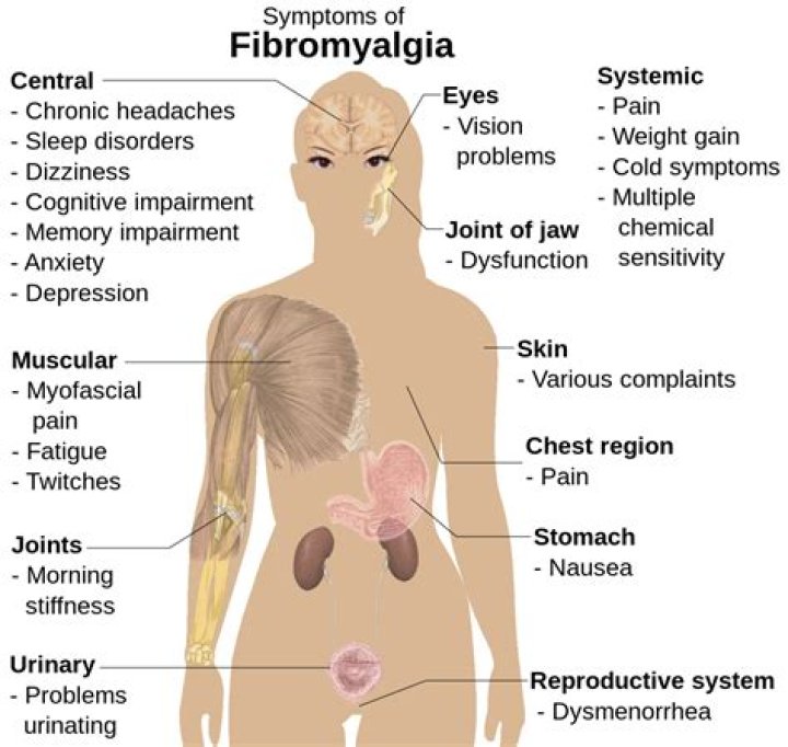 Is fibromyalgia a neurological condition?