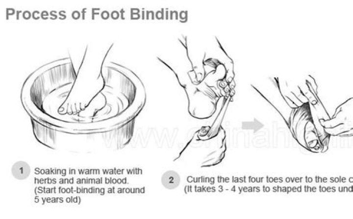 Is foot binding still practiced today?
