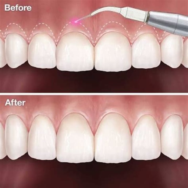 Is gum surgery painful?