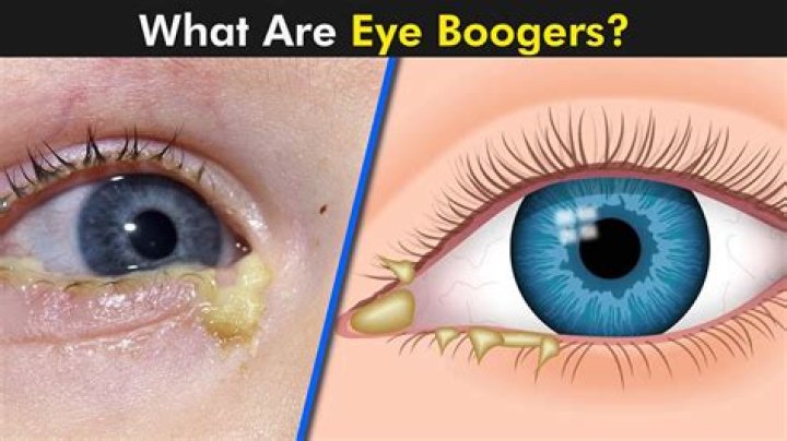 Is it good to eat boogers?