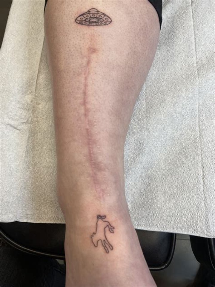 Is it OK to tattoo over scars?