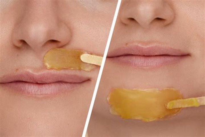 Is it OK to wax upper lip?