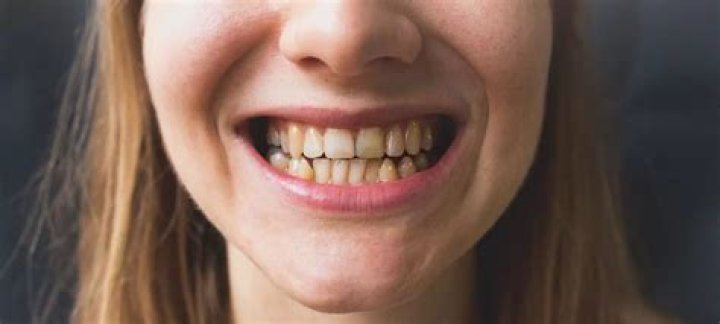 Is it too late to save my gums?