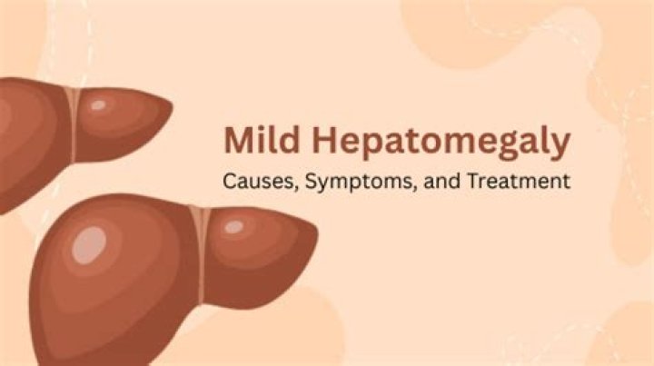 Is mild hepatomegaly reversible?