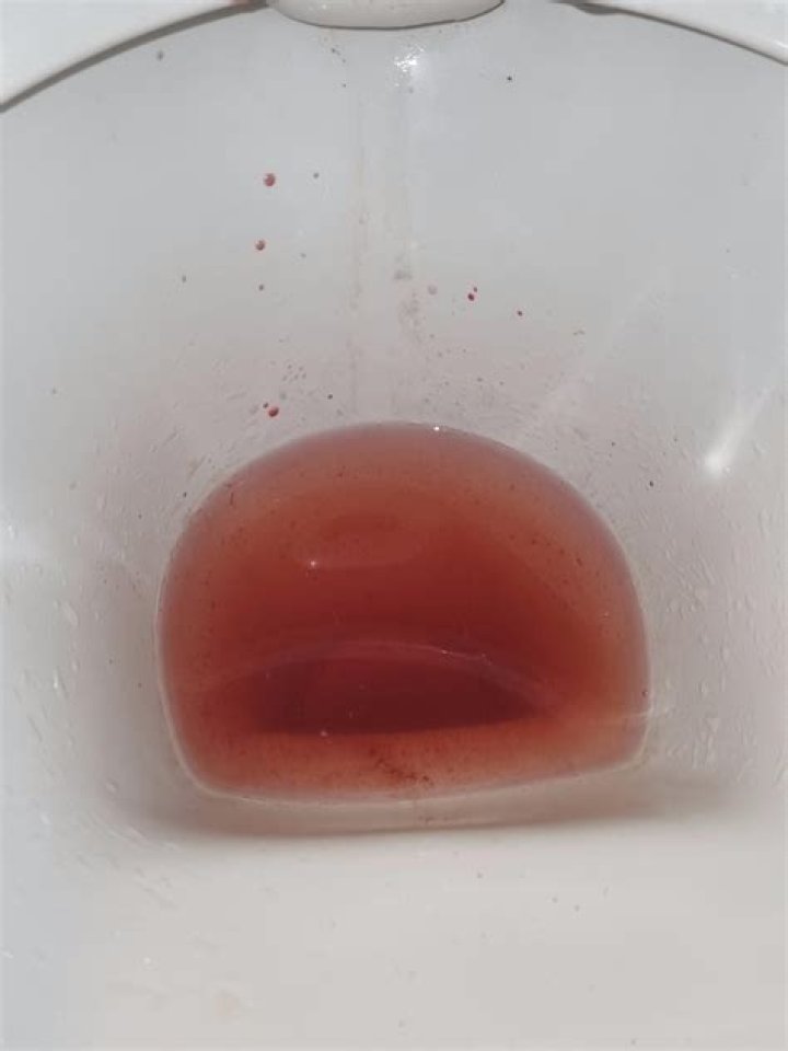 Is peeing once a day normal?