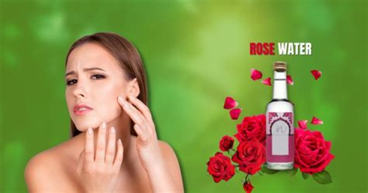 Is rose water good for dry skin?
