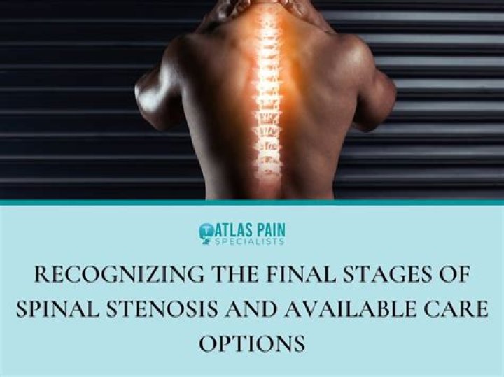 Is spinal stenosis curable without surgery?