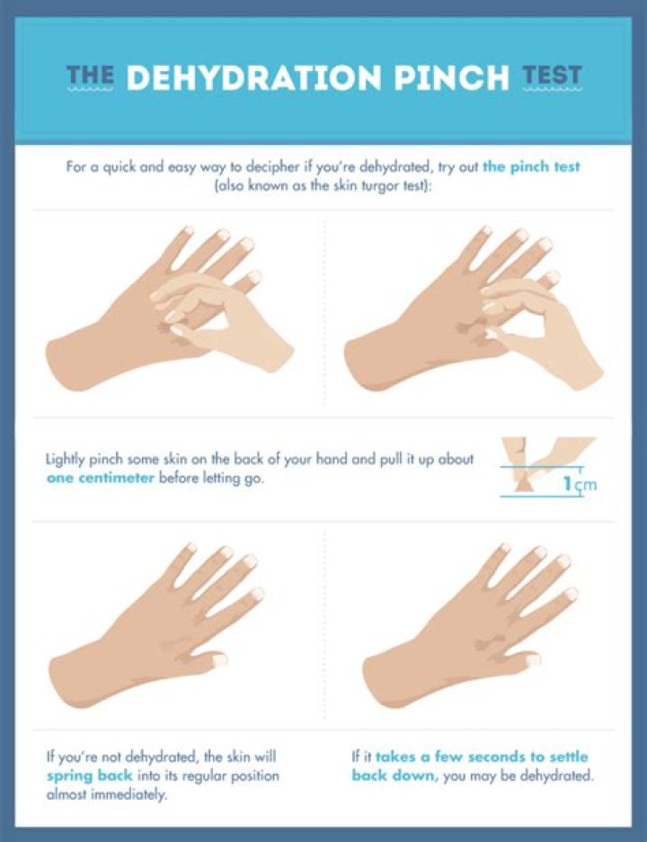 Is the pinch test accurate for dehydration?