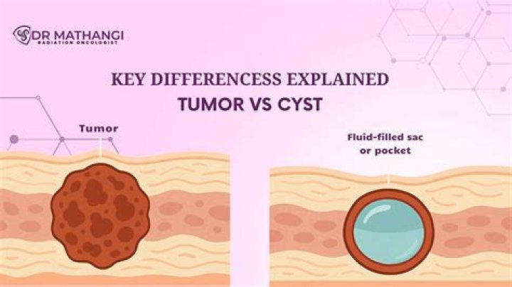 Is tumor and cyst the same?