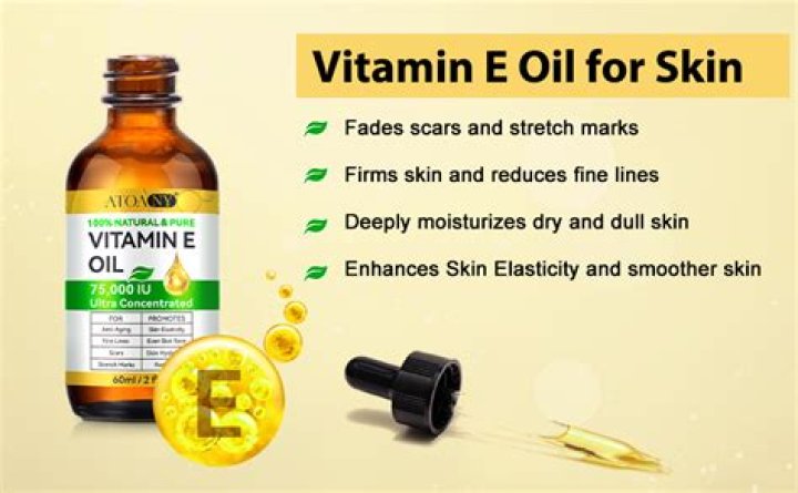 Is vitamin E oil good for vitiligo?