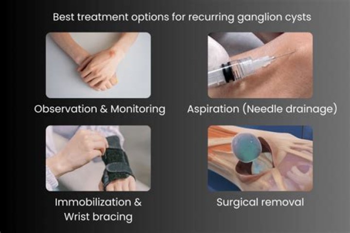 Is wrist surgery risky?