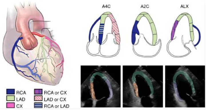 What 5 abnormalities can be found on the echocardiogram?