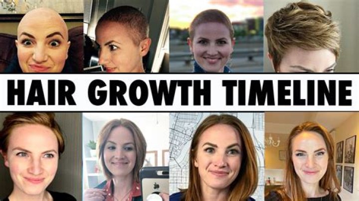 What age does hair start to thin in woman?