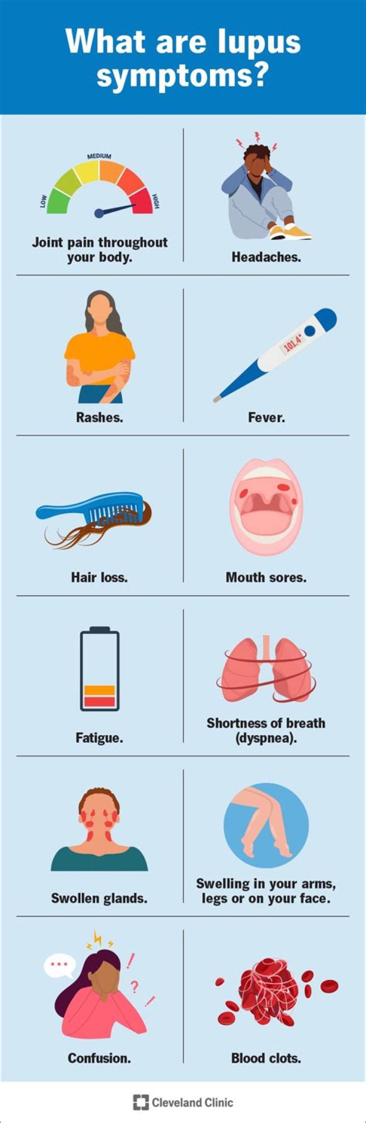 What are symptoms of lupus flare?
