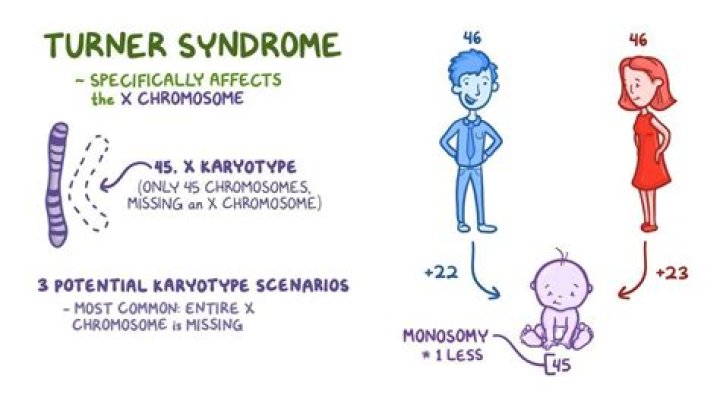 What are the different types of Turner syndrome?