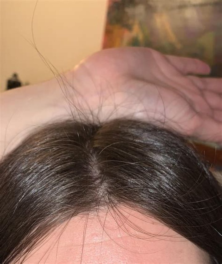 What are the tiny black hairs on my nose?