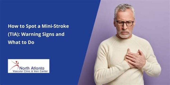 What are the warning signs of a mini-stroke?