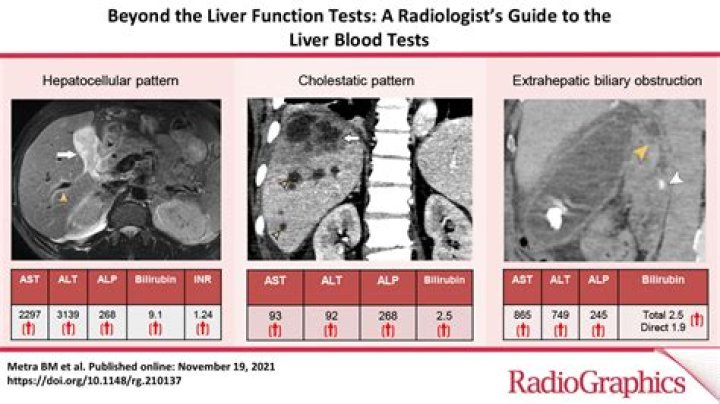What blood tests show liver problems?