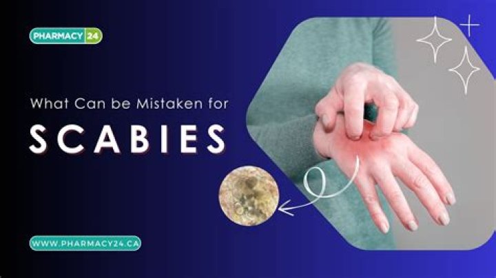 What can be mistaken for MRSA?