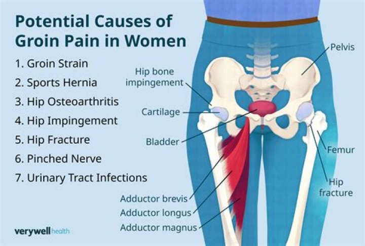 What can cause pain in the groin area of a woman both sides?