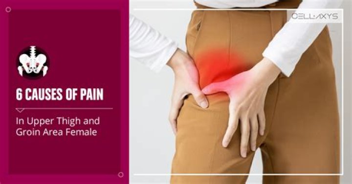 What can cause pain in the groin area of a woman?