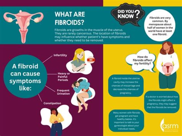 What can dissolve fibroids?