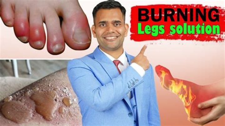 What causes burning feet and legs?