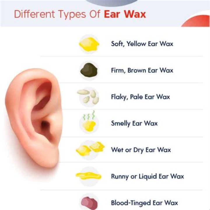 What causes ear wax?