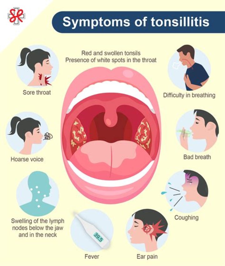 What causes huge tonsils?