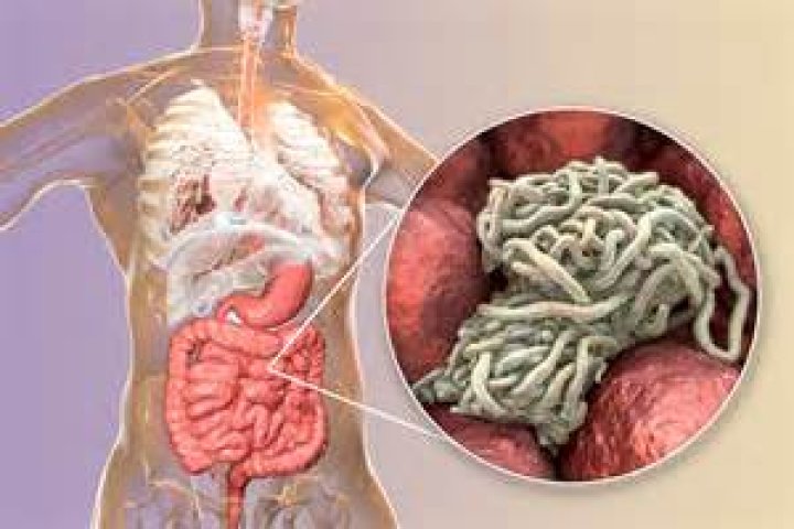 What causes maggot in human stool?