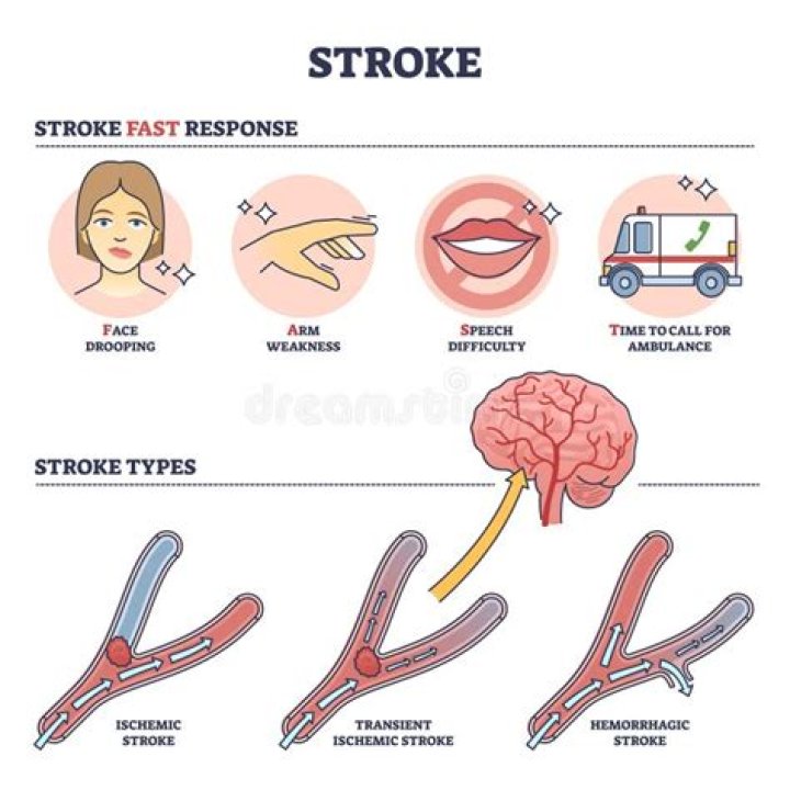 What causes mini strokes in adults?
